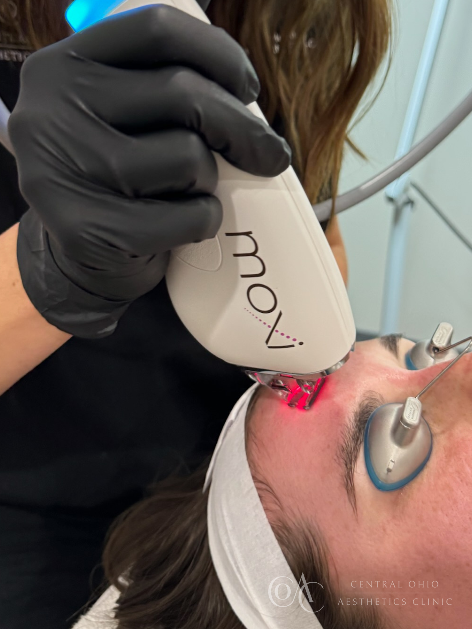 A woman receiving a laser hair treatment at a salon, focused on her hair while a stylist operates the laser device.