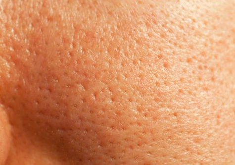 A close-up of a person's face showcasing a prominent display of freckles across their cheeks and nose.