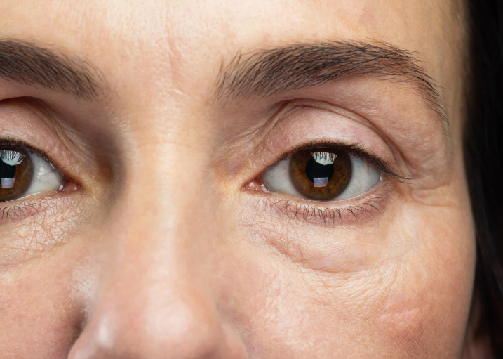 Close-up of a woman's eyes, showcasing their color and expression with a soft focus on the eyelashes. Close-up of a woman's eyes, showcasing their color and expression with a soft focus on the eyelashes.