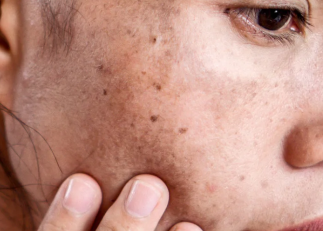 A woman with freckles on her face, smiling softly, showcasing her natural beauty and warm expression.